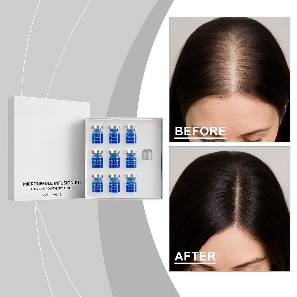 Hair Care Conditioner - Set di Micro-Aghi con Siero Essenziale