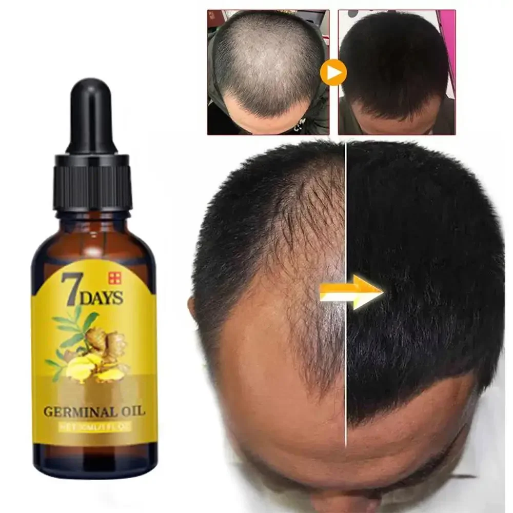 Crescita dei capelli Zenzero C - Hair Care Essence Oil Spray recensione e prezzo